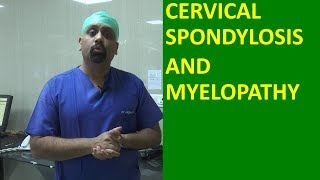 What is Cervical spondylosis Cervical Spinal cord compression and Myelopathy मानेचा संधिवात [upl. by Ylremik868]