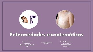 Enfermedades exantemáticas en Pediatría [upl. by Blight]