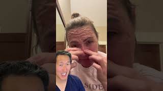 Plastic Surgeon Reacts to DIY Gelatin Face Mask [upl. by Naamana]