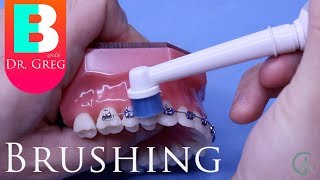 Brushing Your Teeth with Braces [upl. by Silohcin]