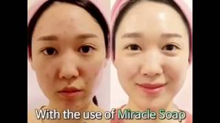 SOME BY MI AHA BHA PHA 30 Days Miracle Cleansing Bar [upl. by Alderson]