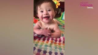 Baby with Down syndrome cant stop smiling [upl. by Pandolfi]