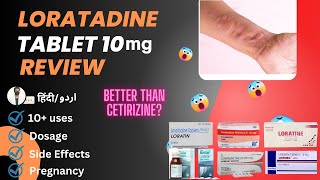 Loratadine  Loratadine 10mg Tablets Used For  Loratadine Tablets 10 mg hindi  Medical Creator [upl. by Ellened]