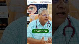 Homeopathic Treatment for Chalazion shorts chalazion homeodoctor [upl. by Salazar772]