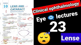 🔴 lense eye lectures 23  clinical Ophthalmology cataract surgery eye cataract [upl. by Yssirhc]