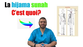 hijama sunnah cest quoi rectification [upl. by Graehl]