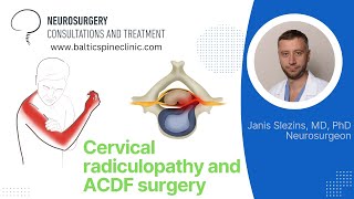 Cervical disc herniation [upl. by Noda6]