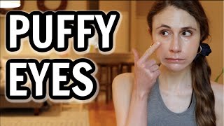 How to get rid of puffy eyes Dr Dray [upl. by Einomrah]