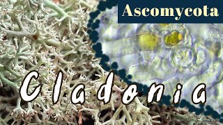 Cladonia arbuscula under the Microscope Mosslike lichensAscomycota [upl. by Janis]