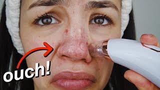 PORE  BLACKHEAD REMOVER VACUUM UP CLOSE FOOTAGE [upl. by Rozalie]