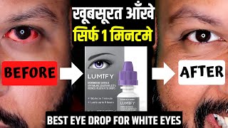 How to get bright eyes  Best eye drops for red eyes  Lumify eye drops [upl. by Sparke119]