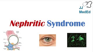 Nephritic Syndrome  Clinical Presentation Causes and Treatment [upl. by Cown]