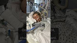 Mother grateful after surviving ruptured brain aneurysm [upl. by Artamas291]