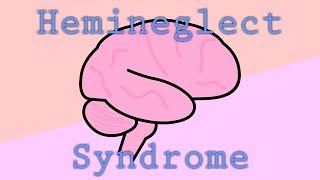 When An Injured Brain Ignores Half The World  Hemineglect Syndrome [upl. by Llertram668]