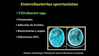 Enterobacterias oportunistas Acinetobacter spp [upl. by Dorsy]