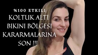 100 ETKİLİ KOLTUK ALTI BİKİNİ BÖLGESİ BEYAZLATMA YÖNTEMİ KOLTUK ALTI KARARMASINA ETKİLİ ÇÖZÜM [upl. by Inoue56]