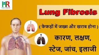 Lung fibrosis in hindi  lung फाइब्रोसिस क्या होता है  lung फाइब्रोसिस के लक्षण कारण जाँच इलाज [upl. by Ferris]