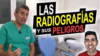 LAS RADIOGRAFÍAS Y SUS PELIGROS  ¿Producen cáncer ¿Debemos evitar las radiografías dentales [upl. by Klina]