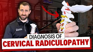 Diagnosing Cervical Radiculopathy Special Tests amp Clinical Insights  Clinical Examination [upl. by Abigale370]