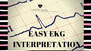 Easy EKG Interpretation in 10 Simple Steps [upl. by Felisha462]