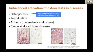 KRWebinar Intravital Imaging for monitoring osteoclast activity within hindlimb long bone [upl. by Estrellita346]