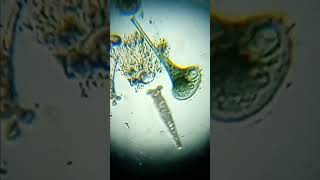 Stentors and Rotifers [upl. by Terbecki]