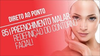 85 Preenchimento Malar Redefinição do Contorno Facial  Direto ao Ponto [upl. by Onailerua60]