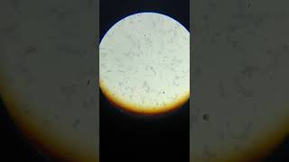 Widal test positive  widal T H positive 180 agglutination microscopic view  widaltest widal [upl. by Nnainot]