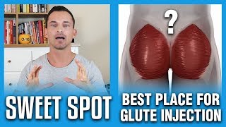 Best Place For Glute Injection  The Sweet Spot [upl. by Neall484]