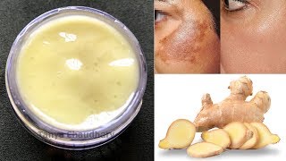 DIY Ginger Cream  Remove Pigmentation Dark Spots amp Acne Scars AntiAging amp Skin Lightening Cream [upl. by Akiwak240]