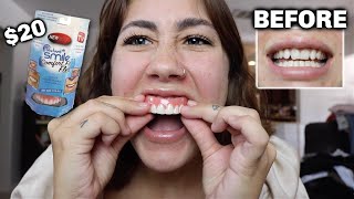 I tried INSTANT VENEERS to see if they actually worked [upl. by Schinica]