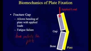 Orthopaedic Implants 1 [upl. by Marcello738]