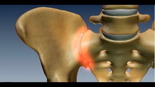 Where is the Sacroiliac Joint Anatomy of the Sacroiliac Joint [upl. by Enened85]