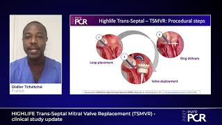 HIGHLIFE TransSeptal Mitral Valve Replacement TSMVR  clinical study update  EuroPCR 2021 [upl. by Marna]