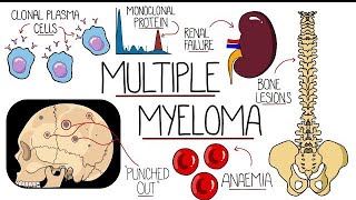 Multiple Myeloma sign and symptoms Treatment Management NCLEXRN REVISION [upl. by Schweiker]