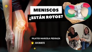 MENISCOS ¿ESTÁN ROTOS [upl. by Inohs]