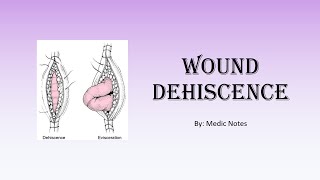 Wound dehiscence  risk factors clinical features investigation management prevention [upl. by Yeldah]