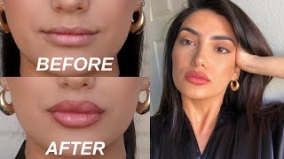 HOW TO FAKE BIG LIPS IN 3 EASY STEPS OMG [upl. by Ashby]