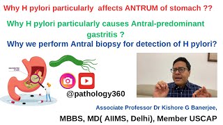 Why H pylori causes Antral predominant gastritis amp particularly affects antrum of stomach hpylori [upl. by Lorie]