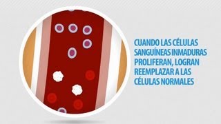 Informacion de la Leucemia [upl. by Ahseena]