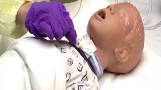 Tracheostomy Suctioning [upl. by Krid948]