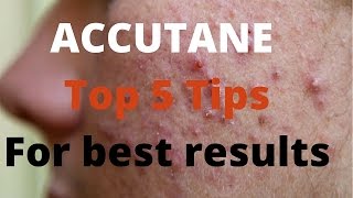 Accutane 5 tips by Dermatologists [upl. by Channing633]