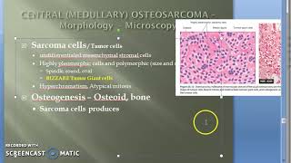 Pathology 828 e OsteoSarcoma Microscopy Giant Cell Osteoid ALP Vimentin Osteocalcin OsteoNectin [upl. by East]