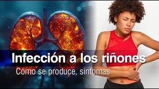 🚨 Infección a los riñones o Pielonefritis aguda cómo se genera síntomas y tratamiento ⚠️ [upl. by Debbra658]