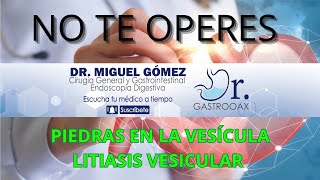 NO TE OPERES  PIEDRAS EN LA VESICULA LITIASIS VESICULAR CUANDO SI Y CUANDO NO OPERARTE [upl. by Cleres]