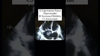 Interatrial Septum Quiz echocardiography [upl. by Noni]