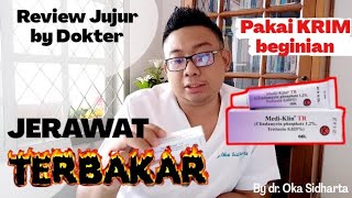 KRIM JERAWAT AMPUH di Apotek Review JUJUR MEDIKLIN by Dokter  Education Series  dr Oka Sidharta [upl. by Anahs]