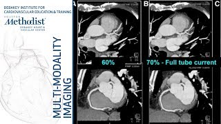 Cardiac CT Current Technology amp Principles Faisal Nabi MD FACC September 11 2018 [upl. by Abbe]