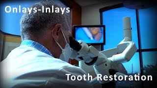 Onlay Tooth Restoration Demonstration  Biomimetic Dentistry [upl. by Rim]