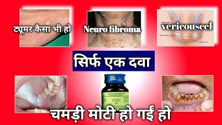 Homeopathic Medicine Calcarea fluorica For surgical condition osmf treatment in hindi  tumorskin [upl. by Nepean]